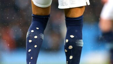 Mengapa pesepak bola ketika ini melubangi kaus kakinya? Hal ini alasannya